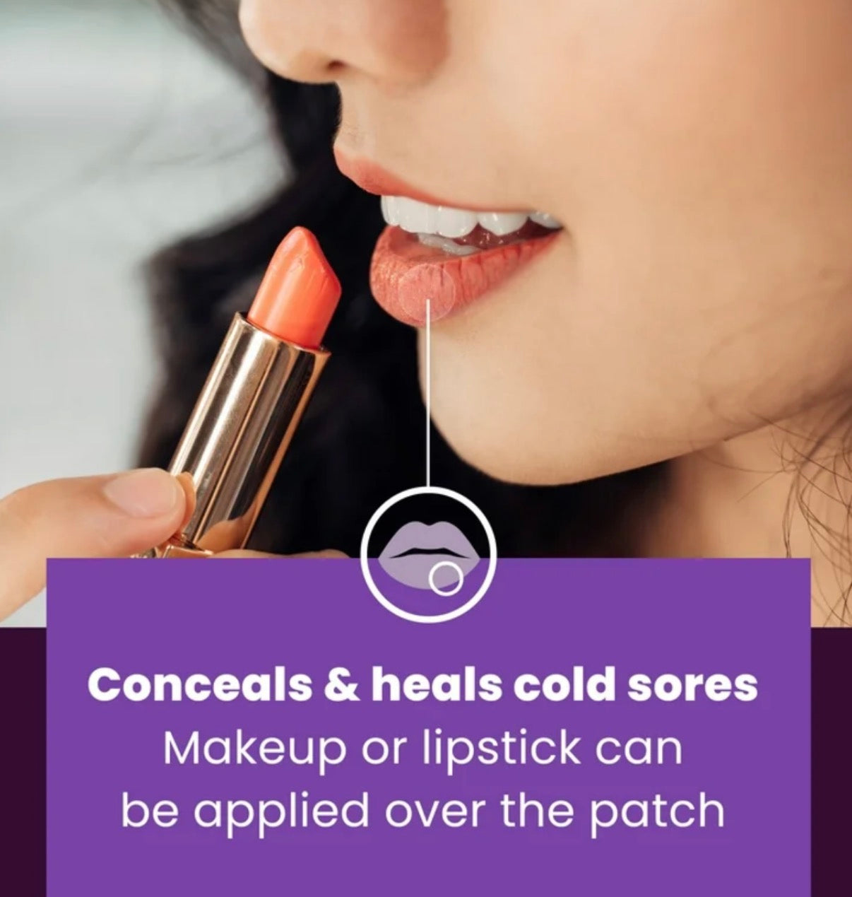 Mederma Cold Sore Discreet Healing Patch 15 count Easy No Touch Applicator